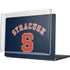 Syracuse University S Blue MacBook Pro 14in (2021-24) Case plus Skin